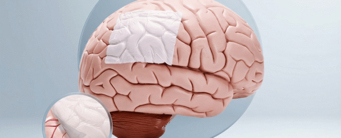 Substituto de dura-máter: flexibilidade e segurança em neurocirurgia
