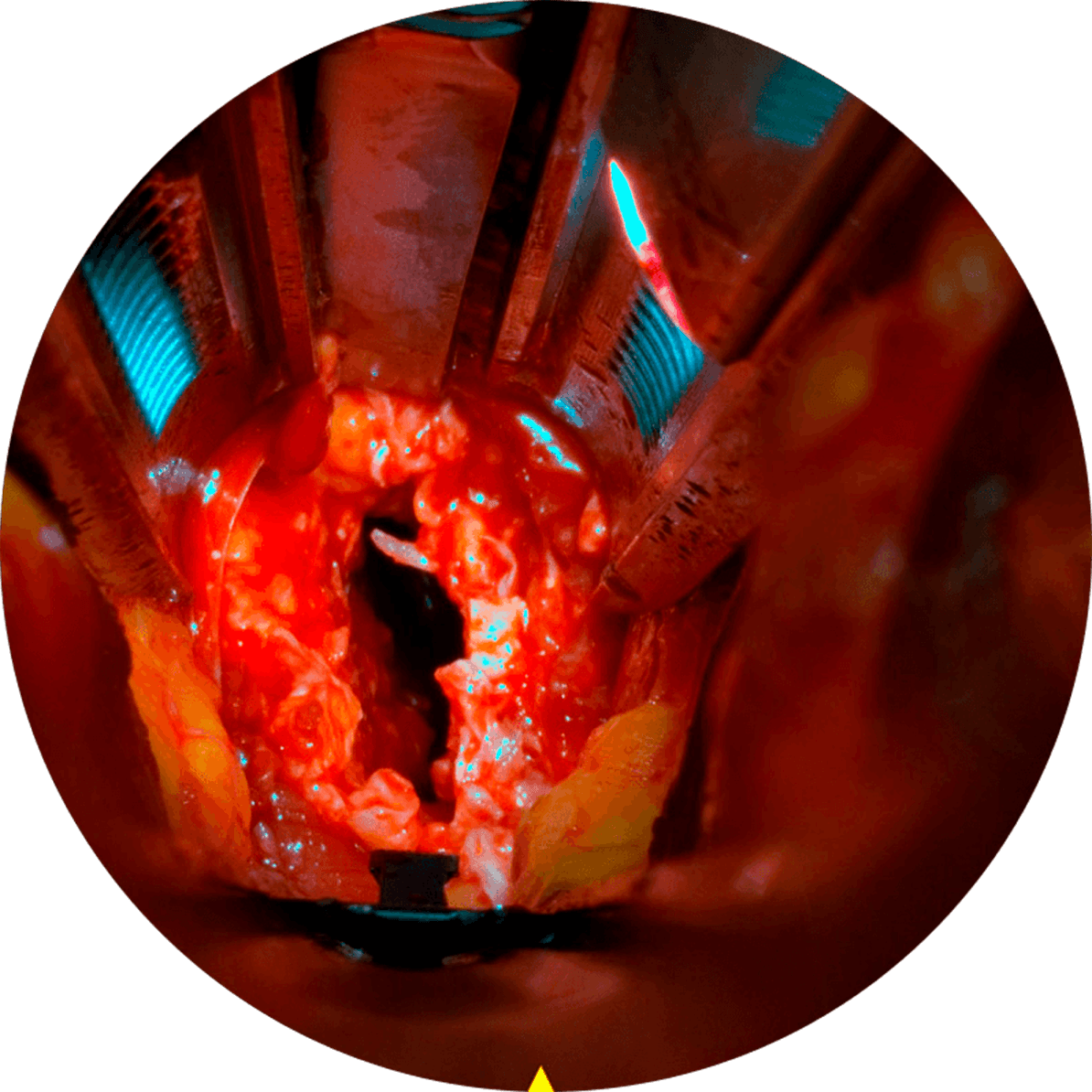 misscope_maxview (5)